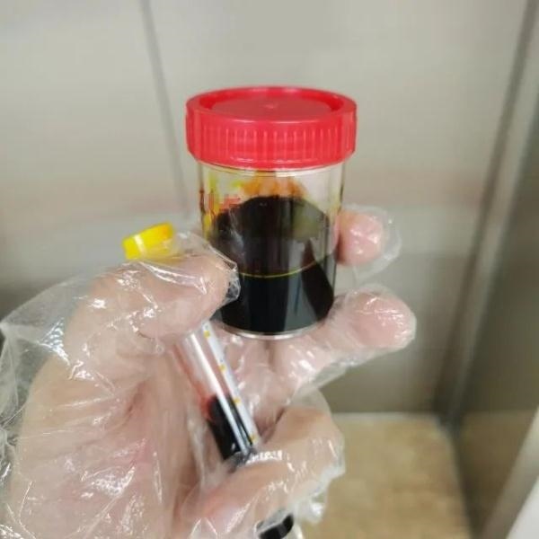 急性肝衰竭！兩兄弟誤吃這種菌 專家提醒
